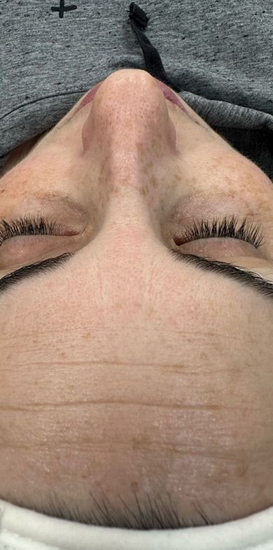 Medicina estética