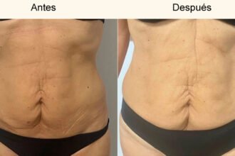perdida-de-barriga